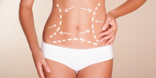 cirugia de abdomen - cirugia estetica dexeus